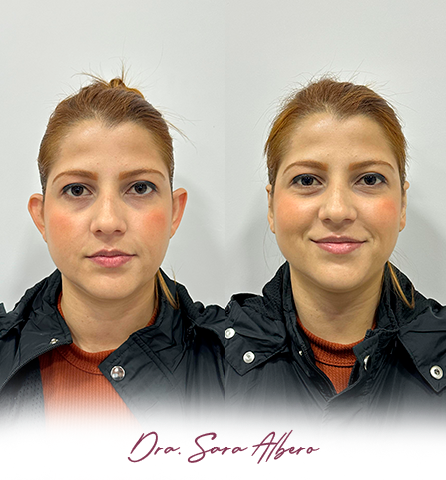 Dra-Sara-antes-e-depois-02